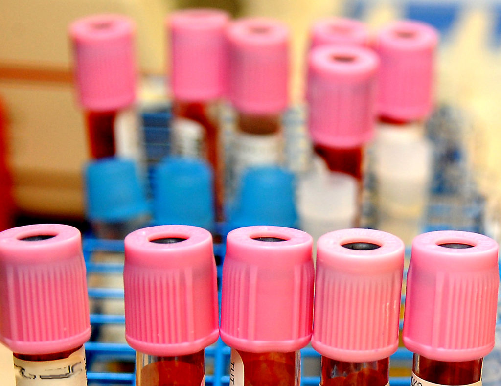 Biocompatibility blood test