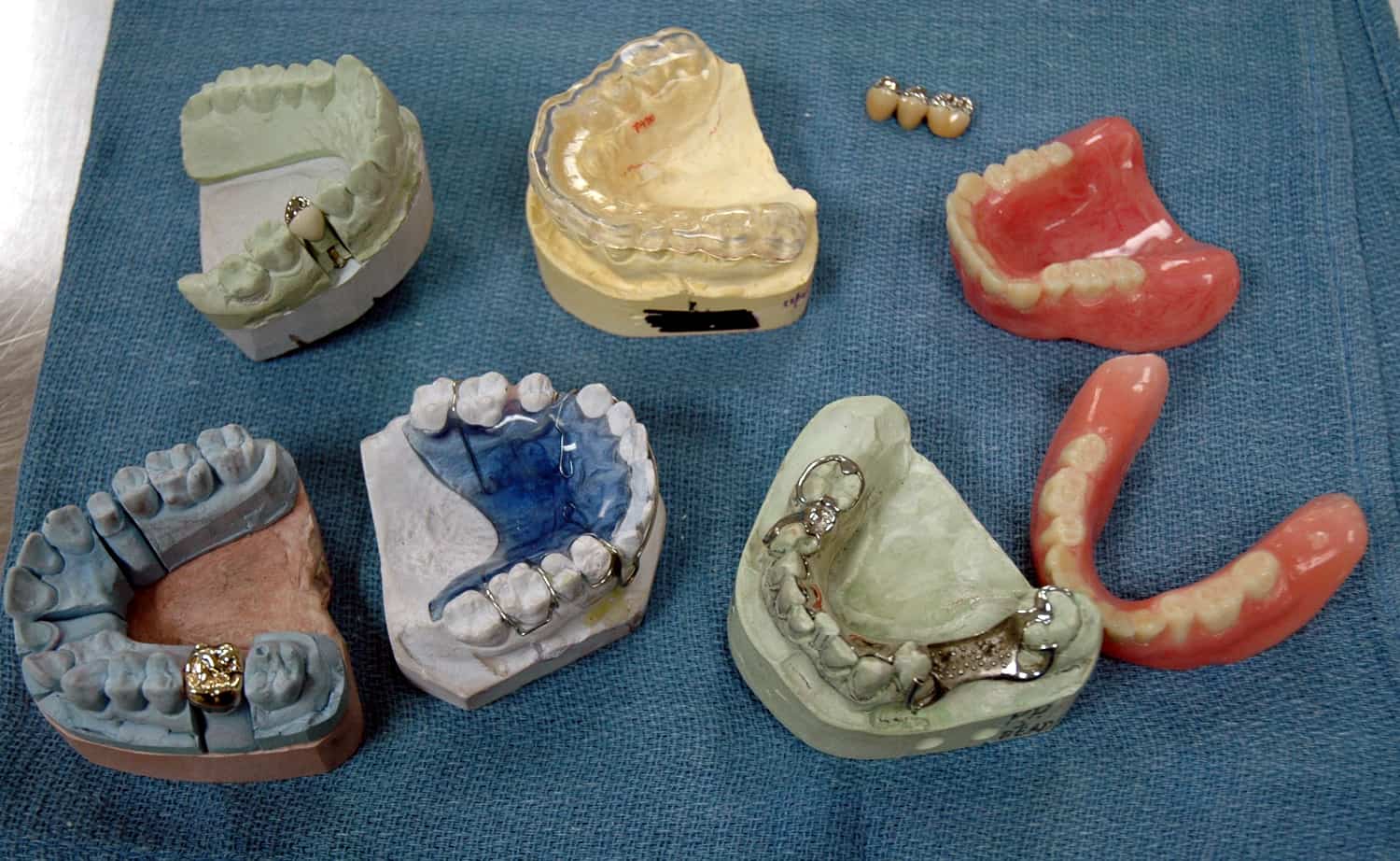 Dental Materials and Your Overall Health Explore Holistic
